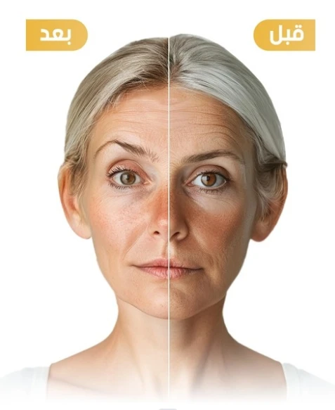 قناع ريتينول وذهب للعناية بالبشرة – Retinol Gold Mask
