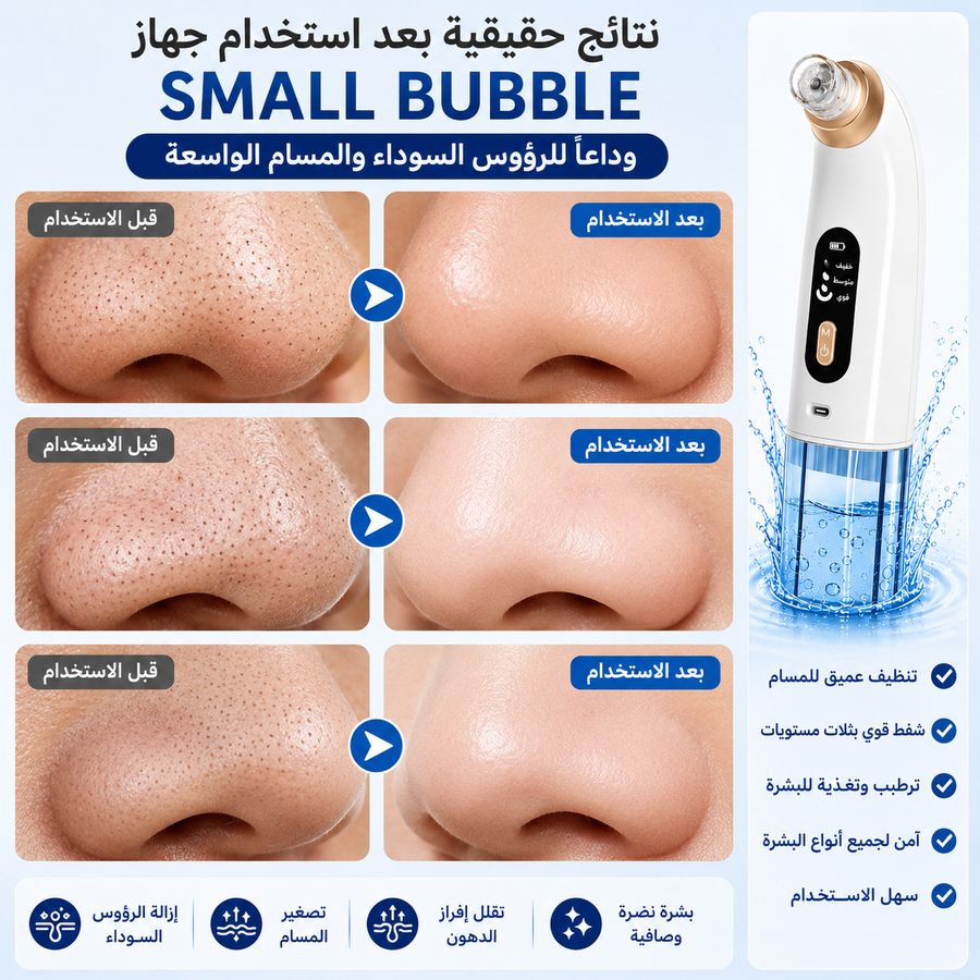 مميزات جهاز Small Bubble