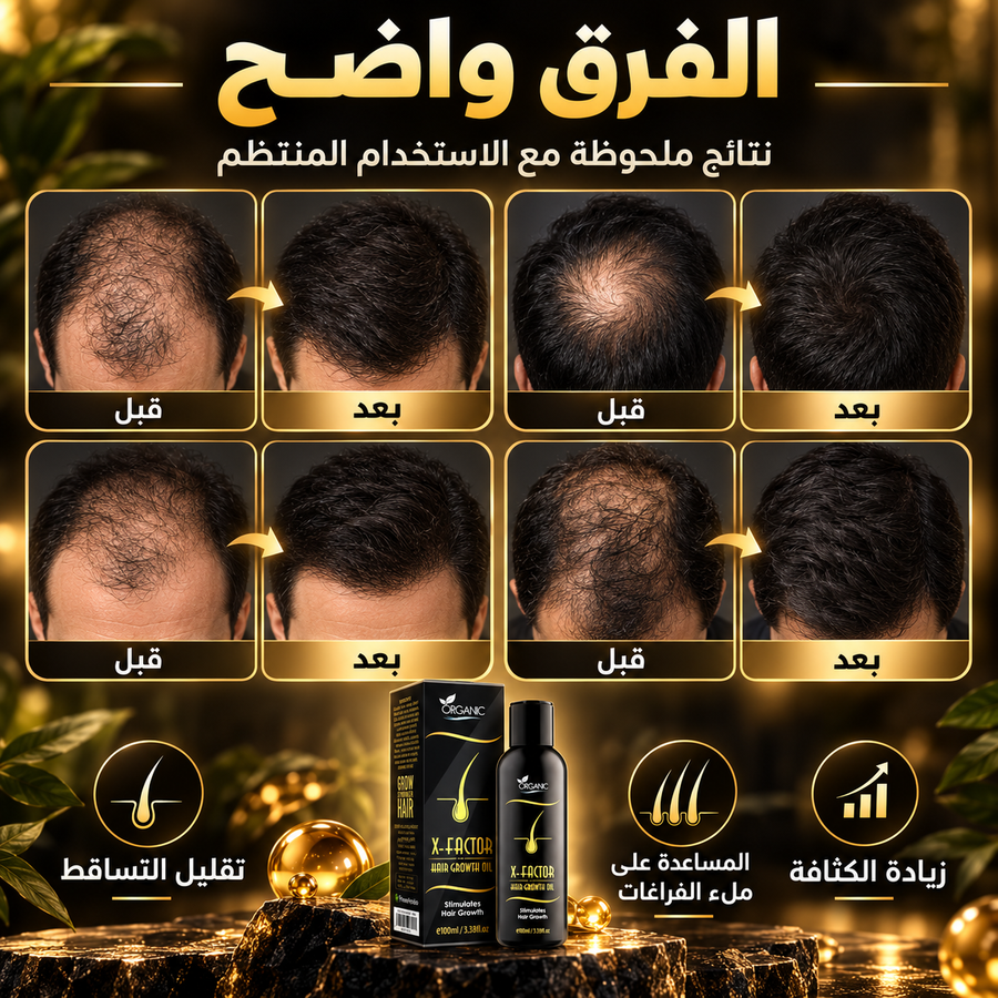 نتائج فاكتور هير
