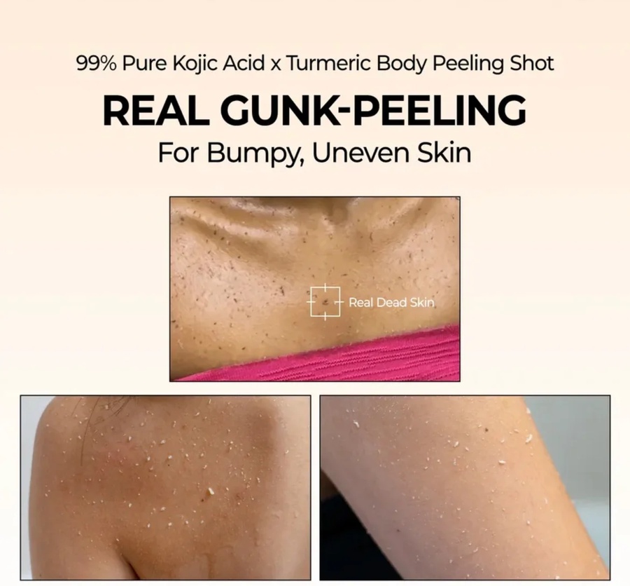Dr.Melaxin Peel Shot Kojic Acid Turmeric Body Spray 200ml