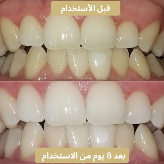 بعد ٨ أيام، الفرق واضح