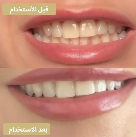 نتيجة من عميل جرّبها