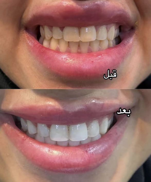 فرق يتكلم عن نفسه