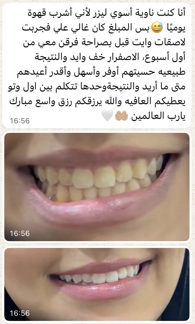 "أوفر وأسهل من الليزر"