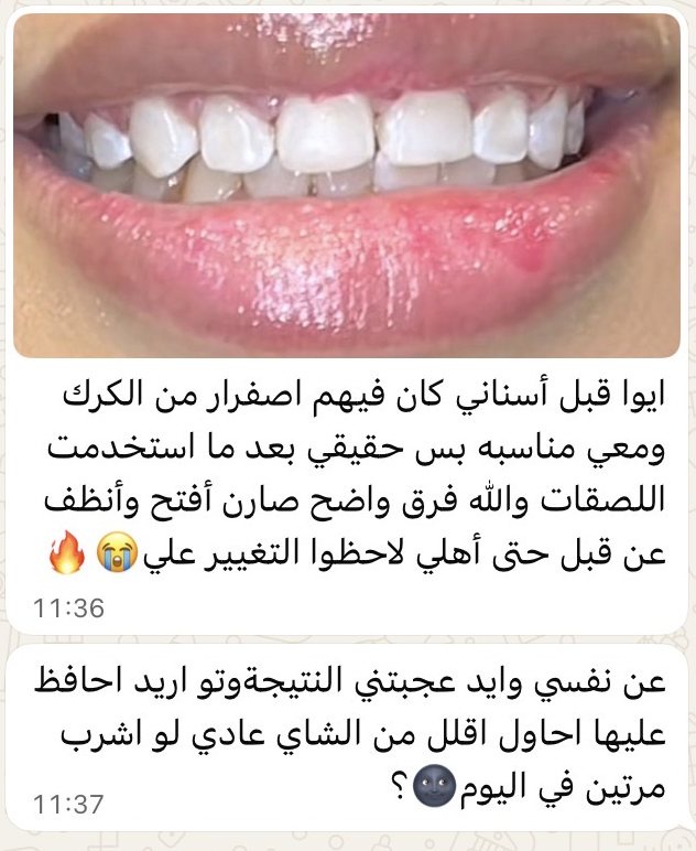 حتى أهلها لاحظوا التغيير