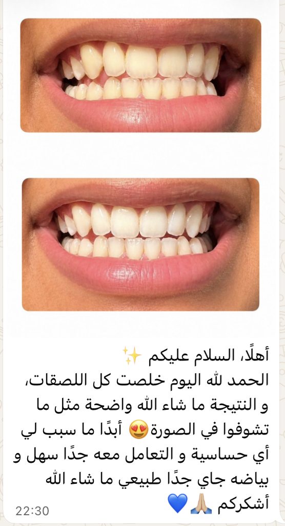 نتيجة واضحة بدون حساسية