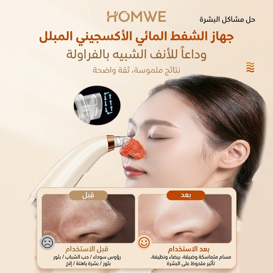 جهاز شفط الرؤوس السوداء وتنظيف البشرة بالماء