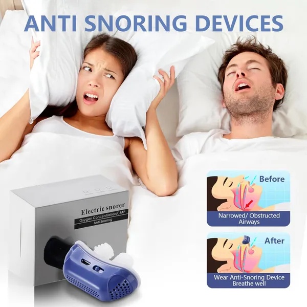 جهاز مضاد للشخير الذكي Anti-Snoring Device - مهدئ ومحسن التنفس قابل للشحن بـ USB